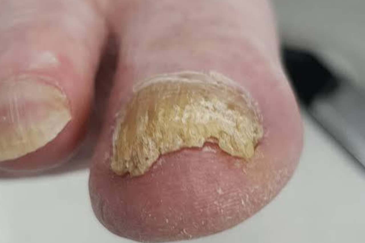 Nail and foot care