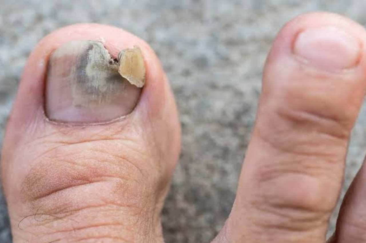 Nail and foot care