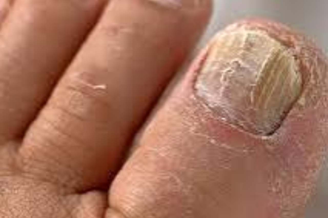 Nail and foot care