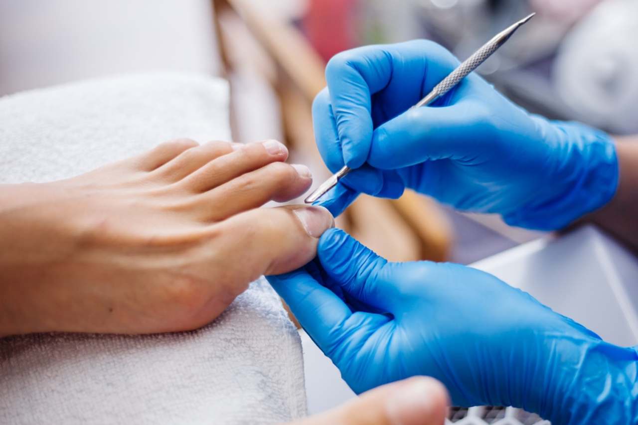 Nail and foot care