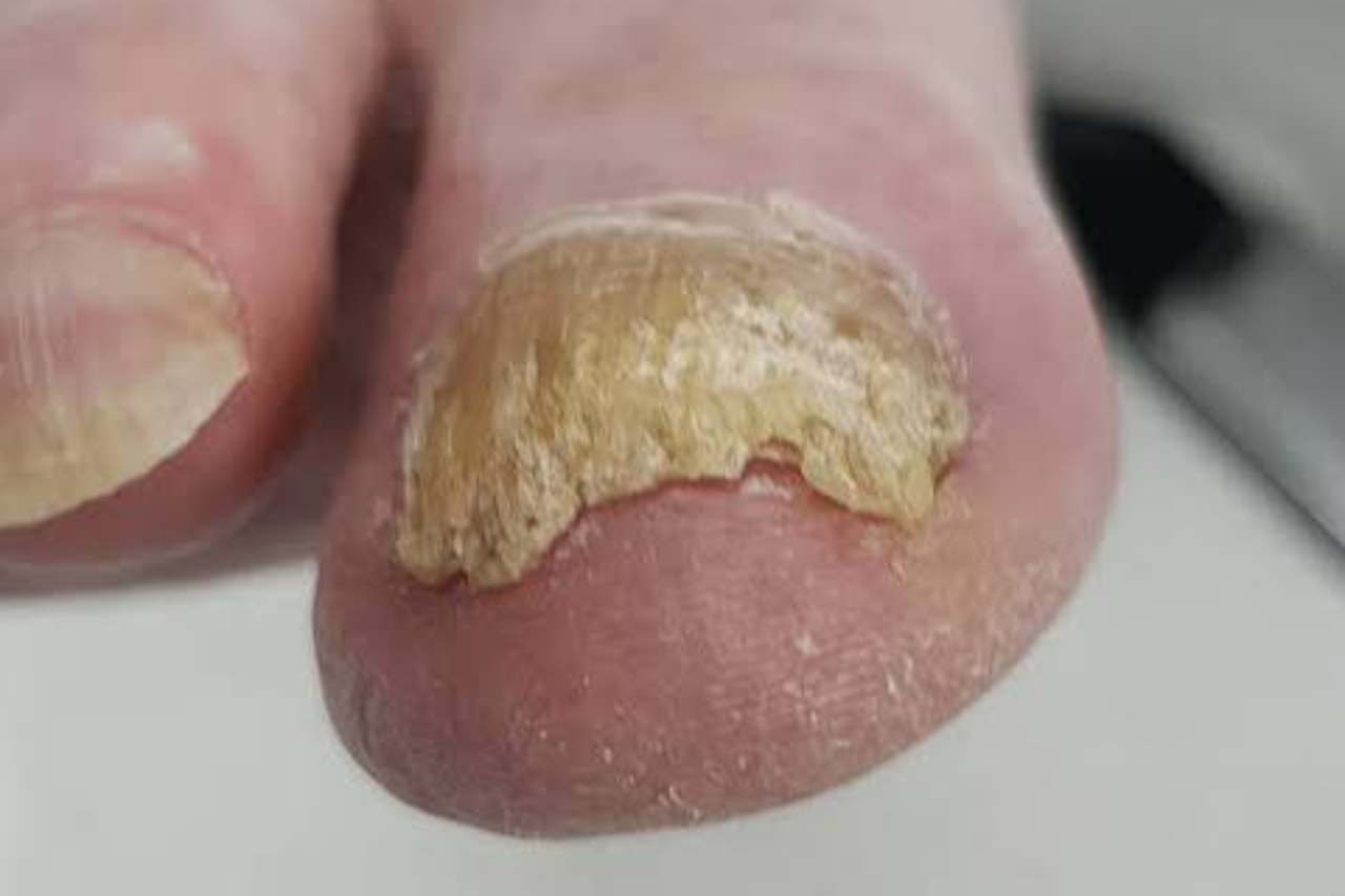Nail and foot care