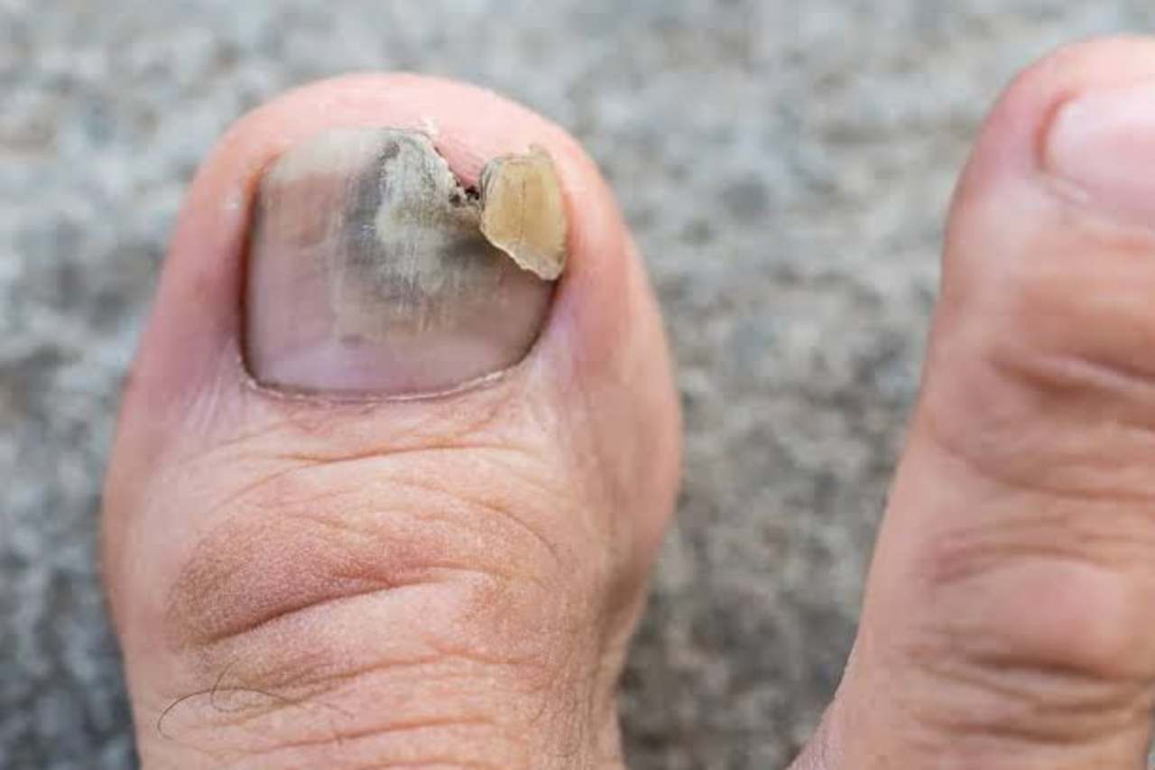 Nail and foot care