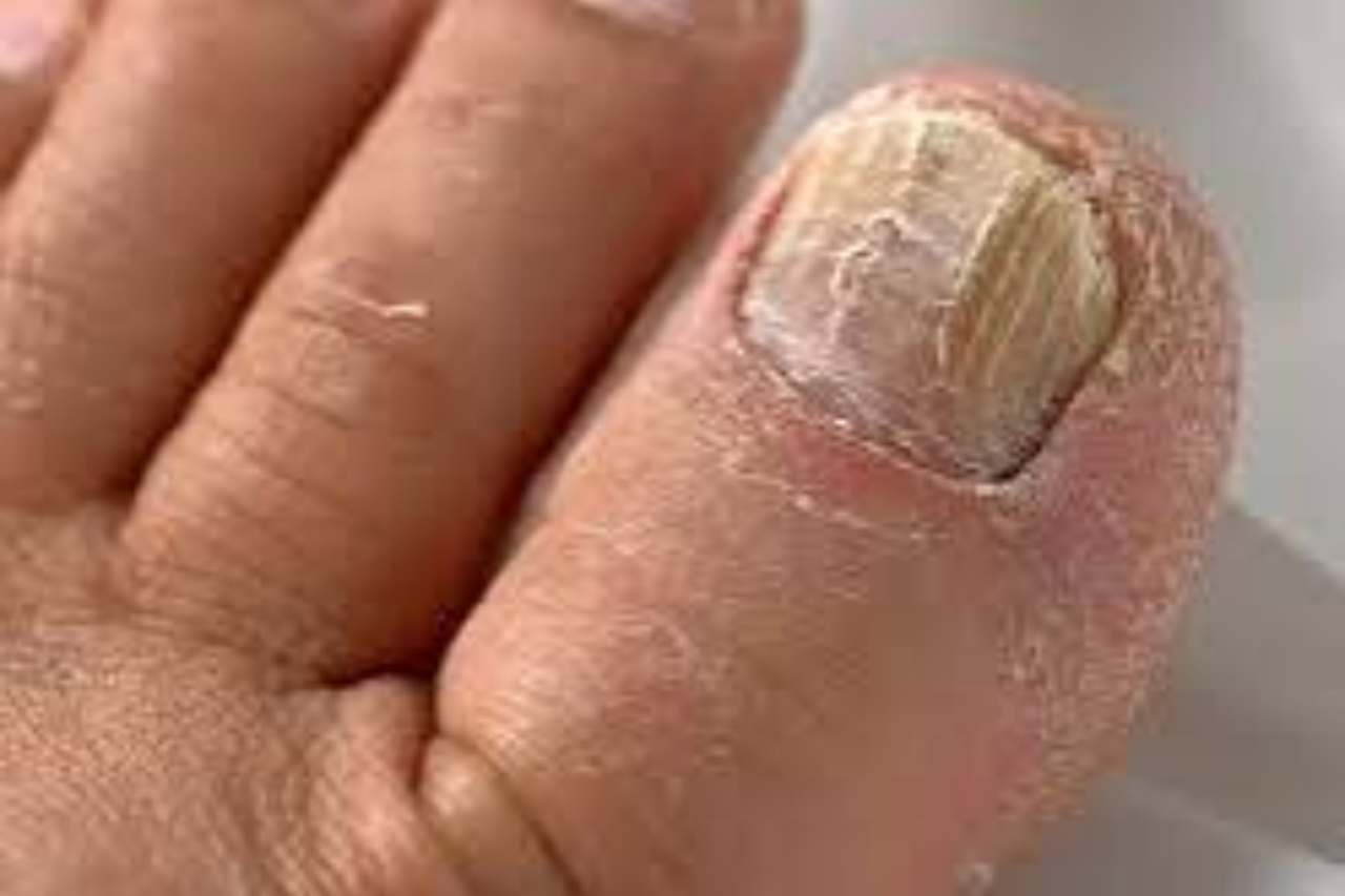 Nail and foot care