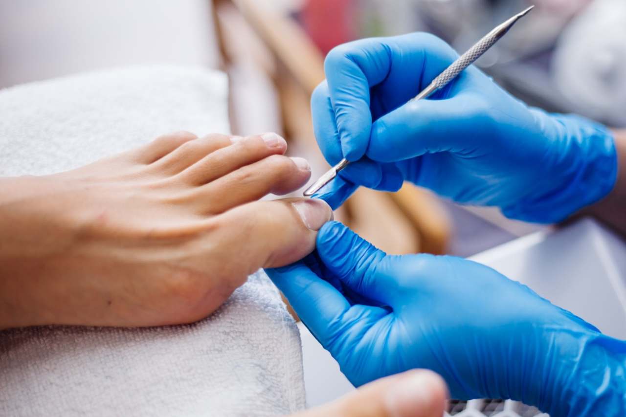 Nail and foot care