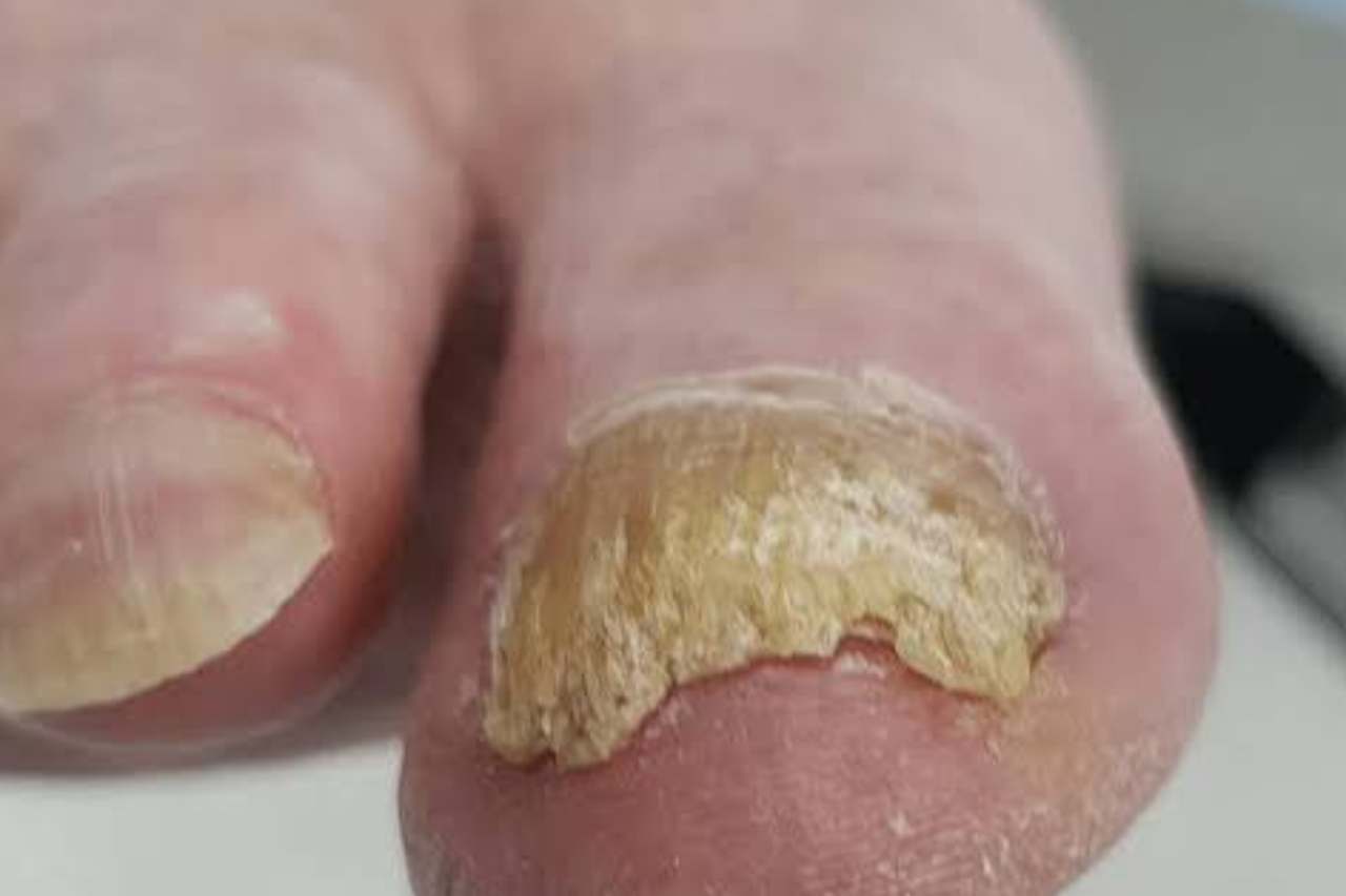 Nail and foot care
