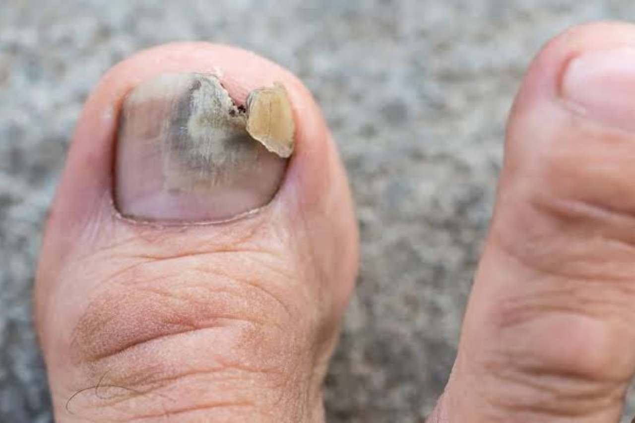Nail and foot care