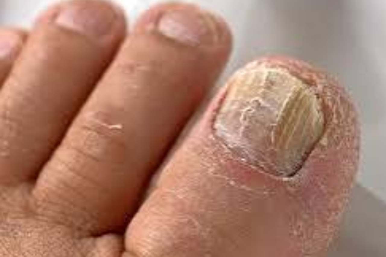 Nail and foot care