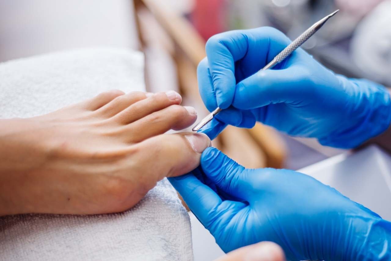 Nail and foot care