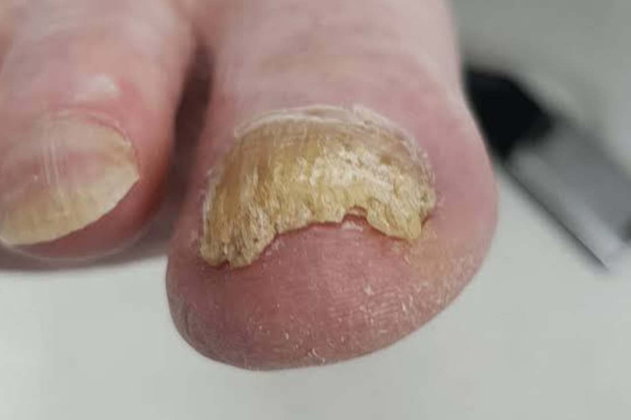 Nail and foot care
