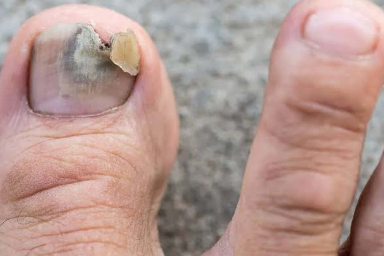 Nail and foot care