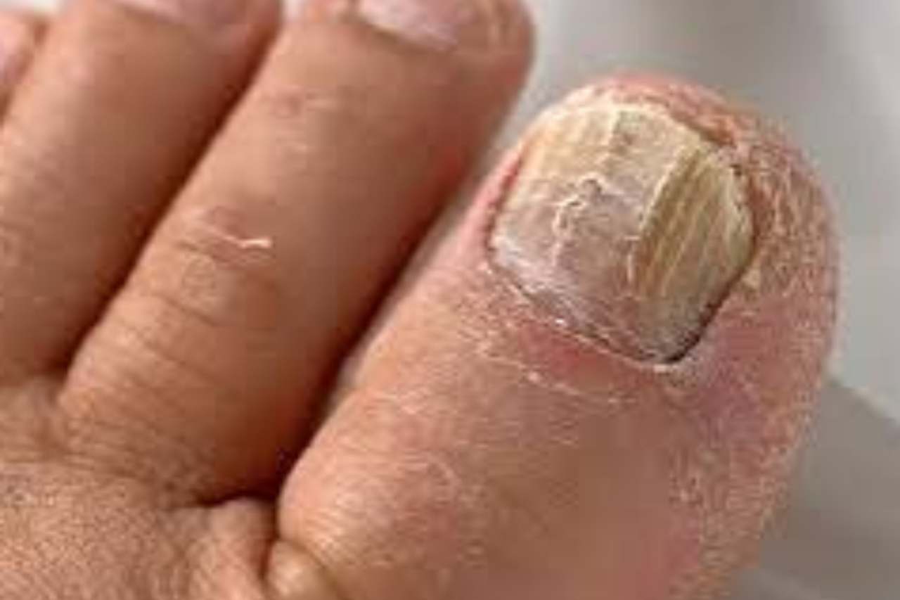 Nail and foot care