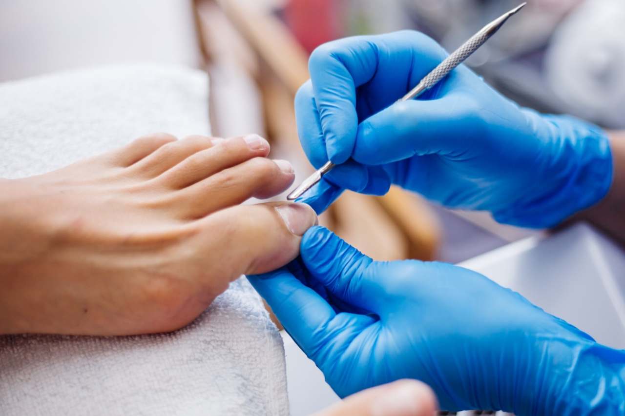 Nail and foot care