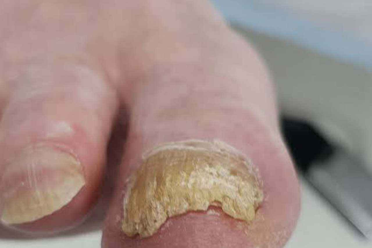 Nail and foot care