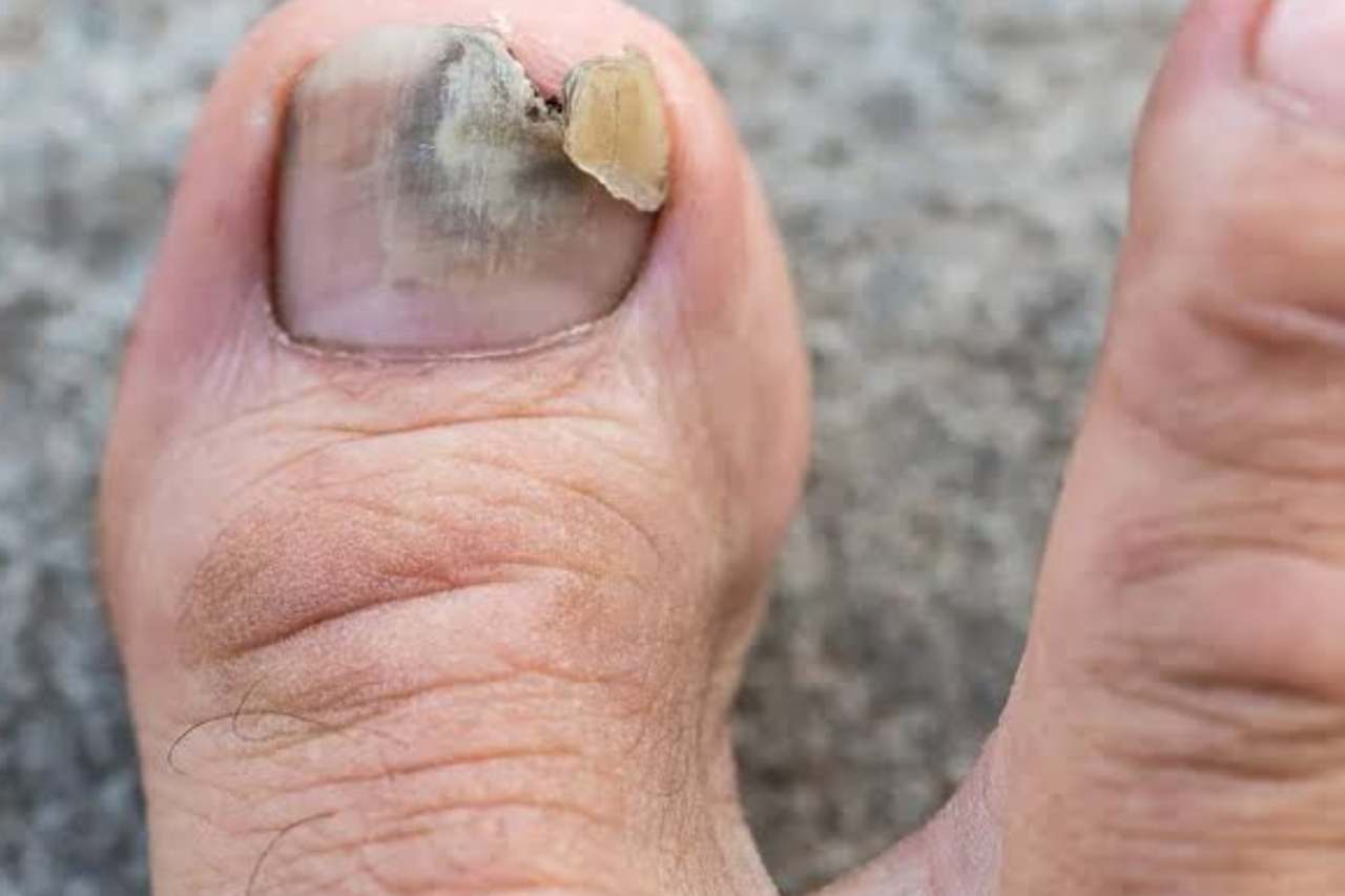 Nail and foot care