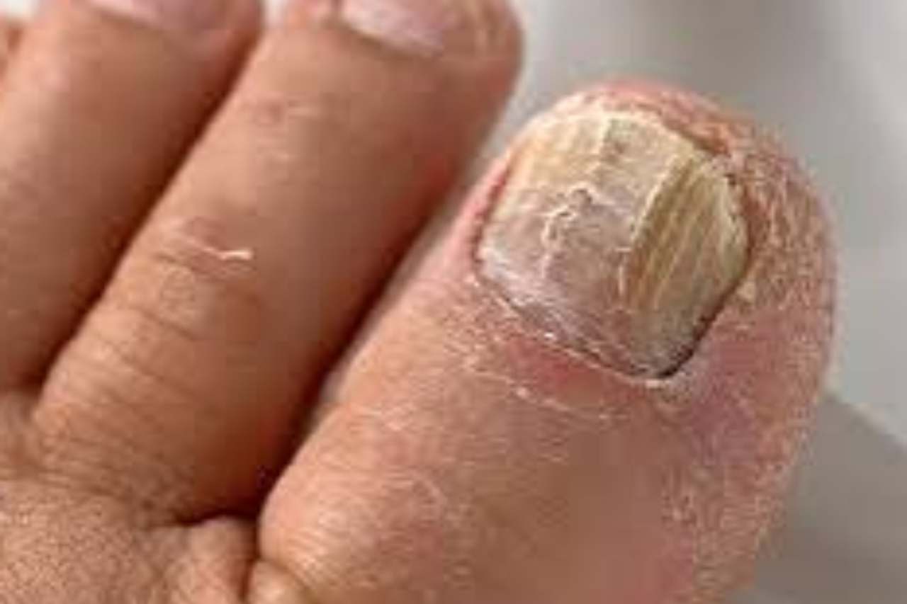 Nail and foot care