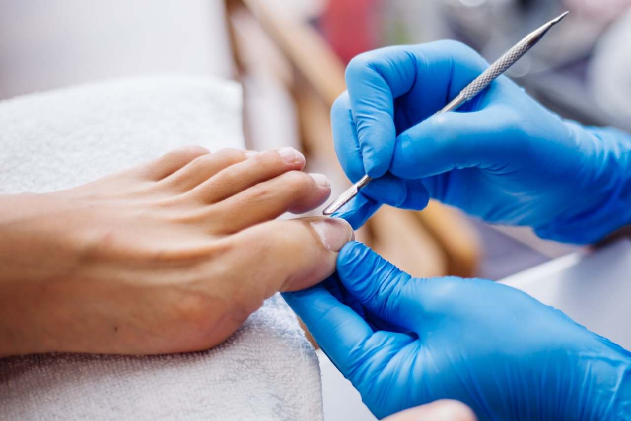 Nail and foot care