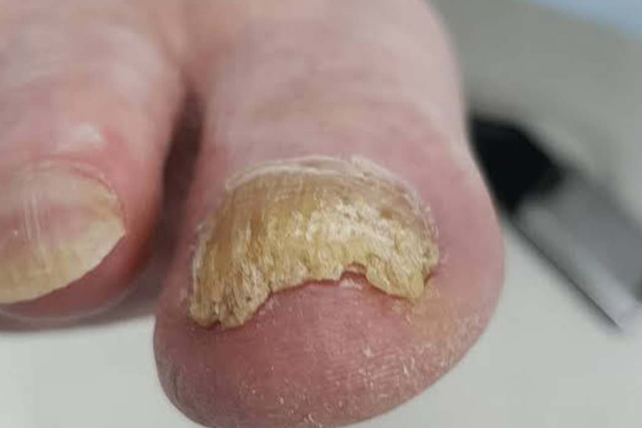 Nail and foot care