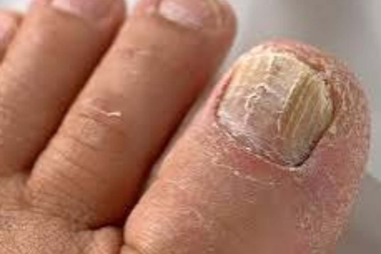 Nail and foot care