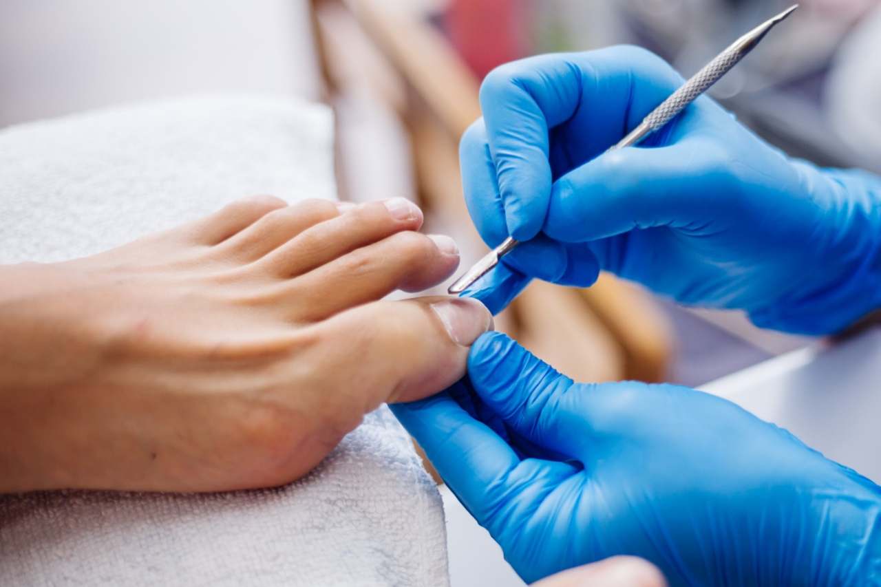 Nail and foot care