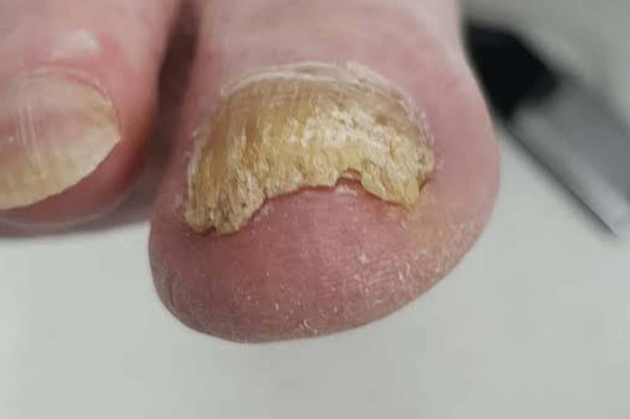 Nail and foot care