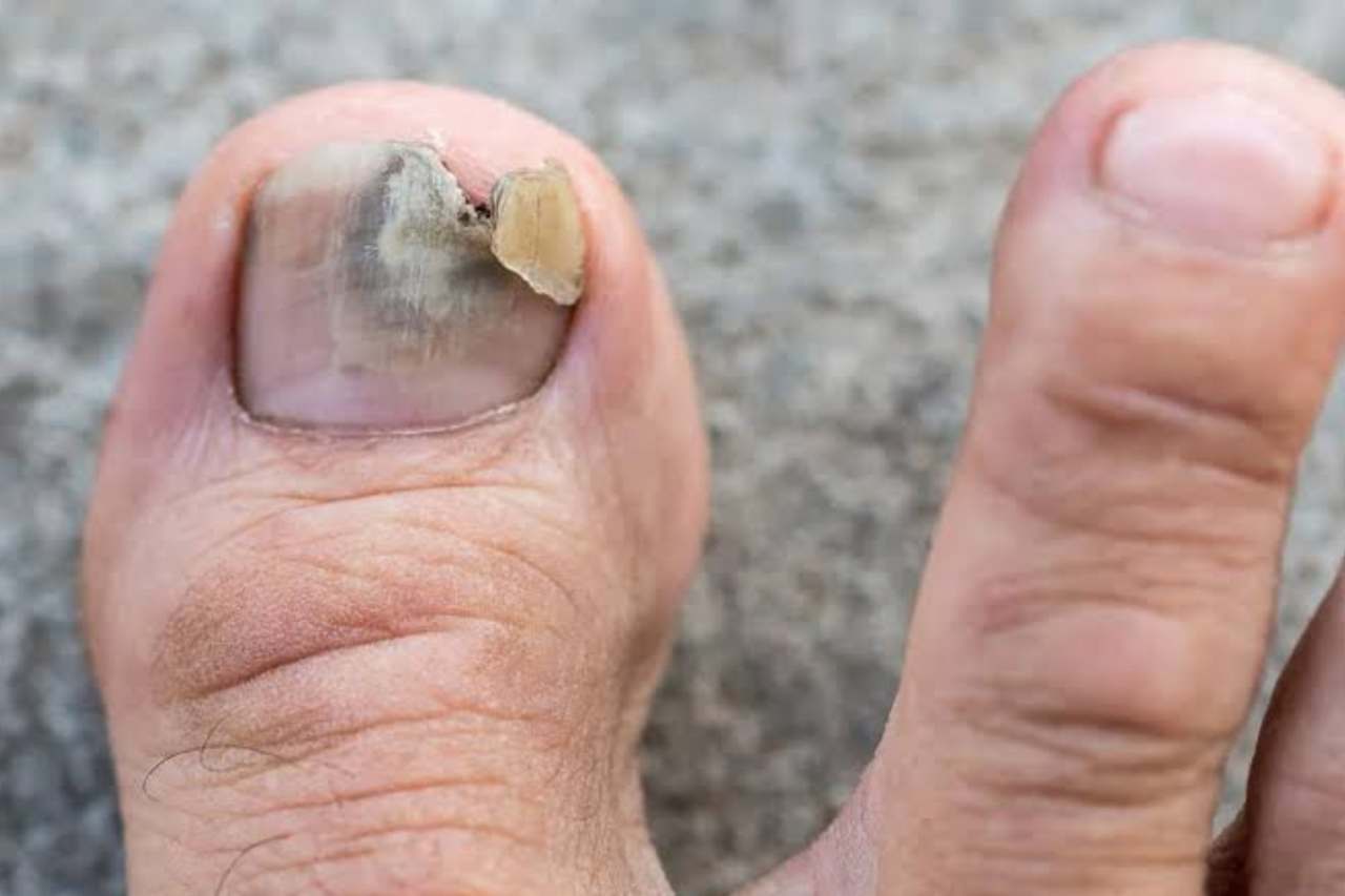 Nail and foot care