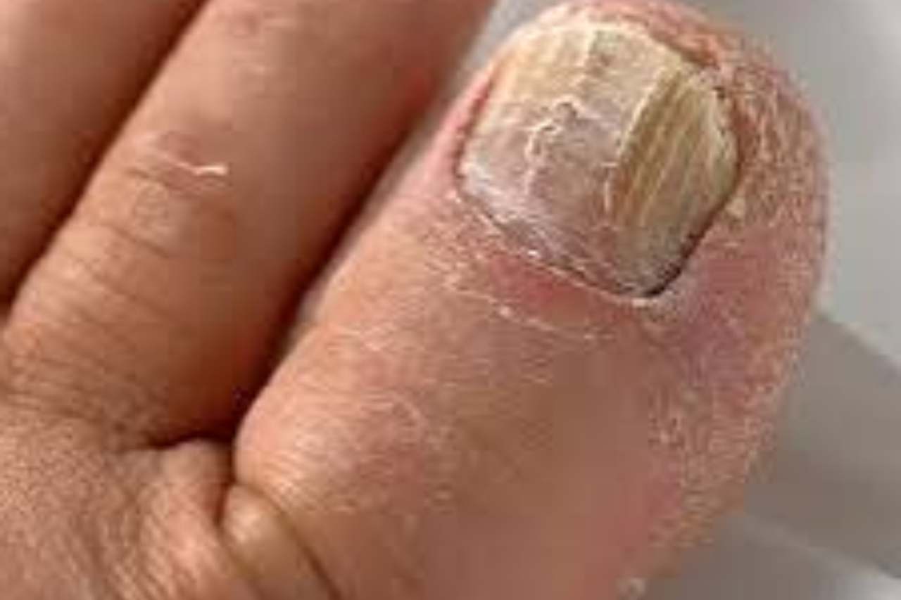 Nail and foot care