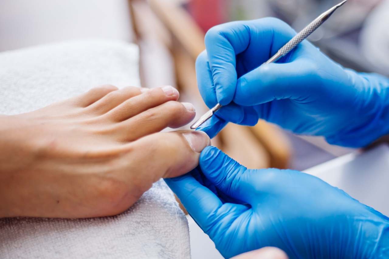 Nail and foot care