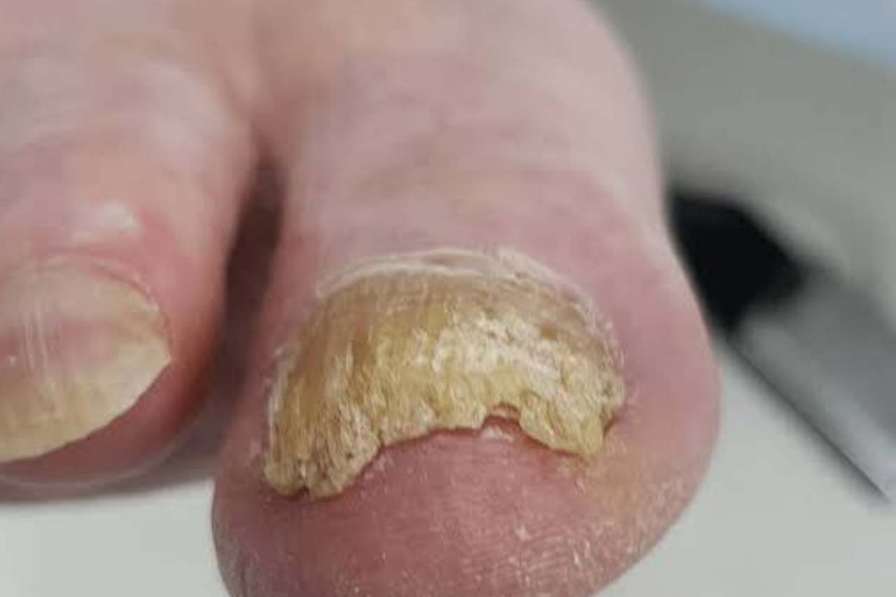 Nail and foot care