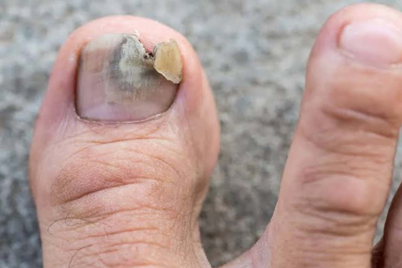Nail and foot care