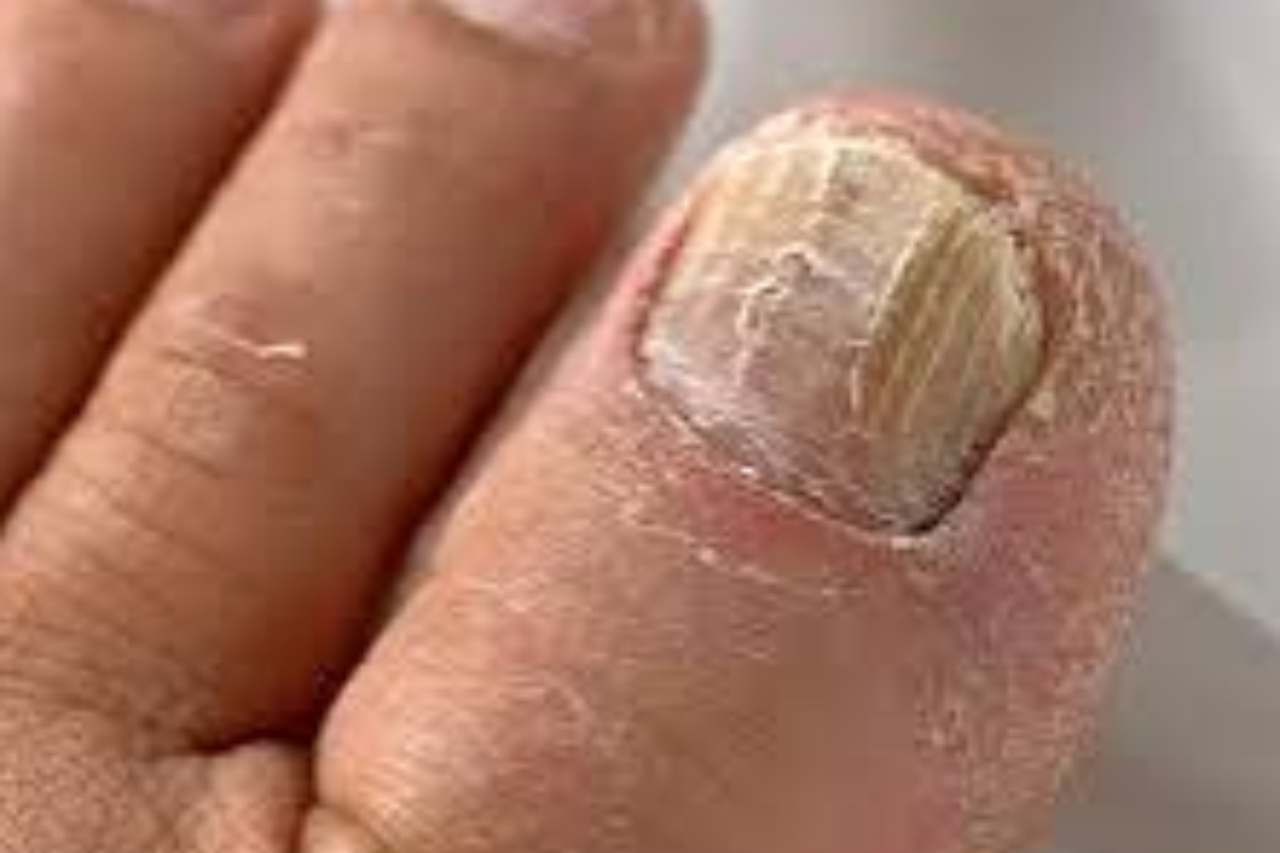 Nail and foot care