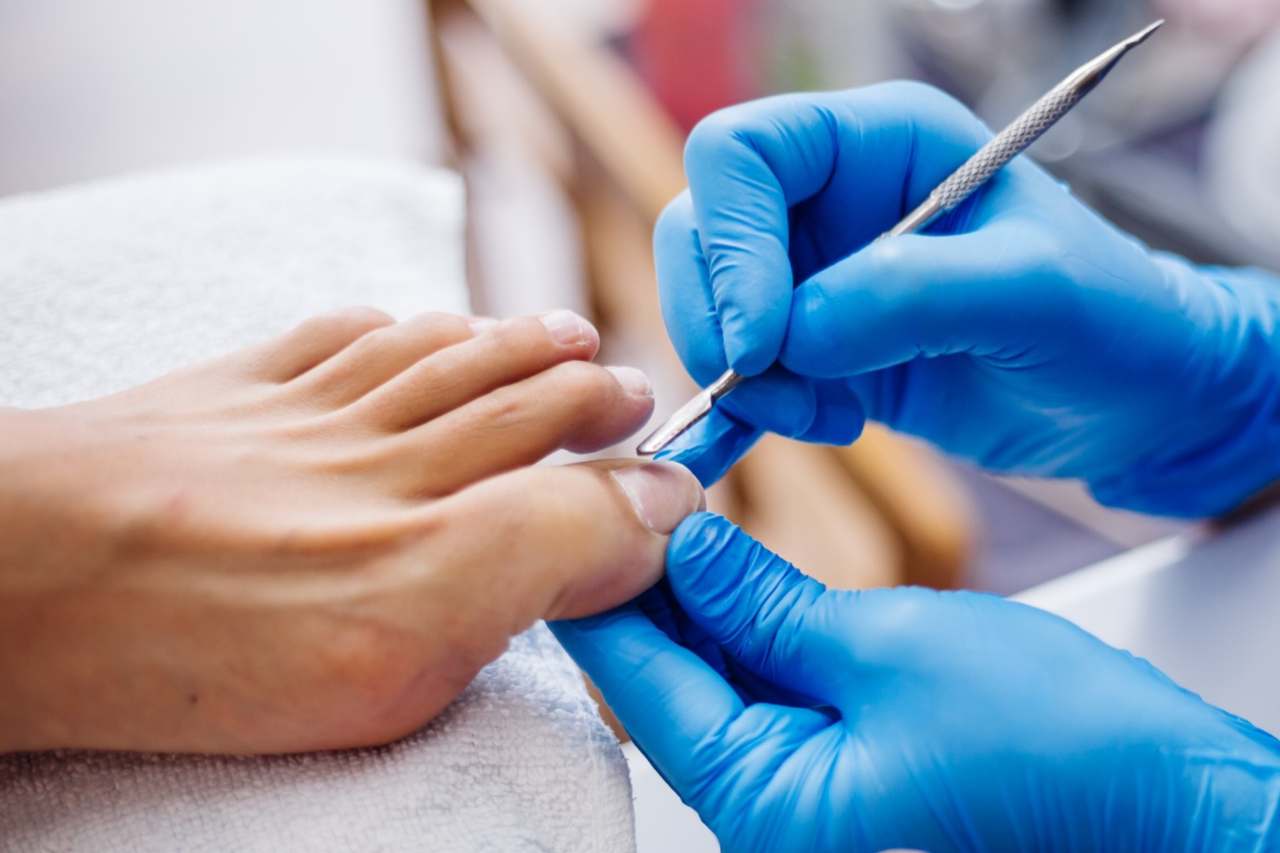 Nail and foot care