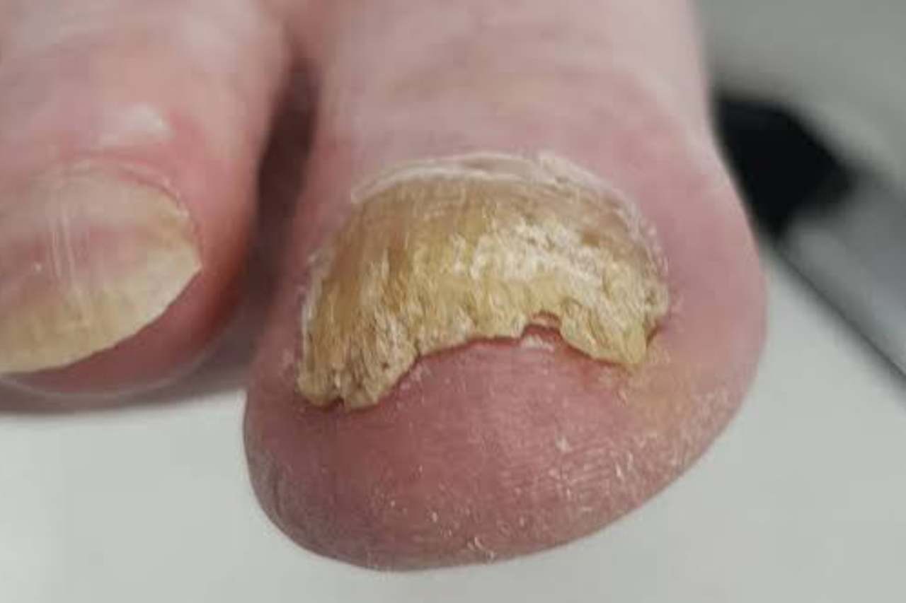 Nail and foot care