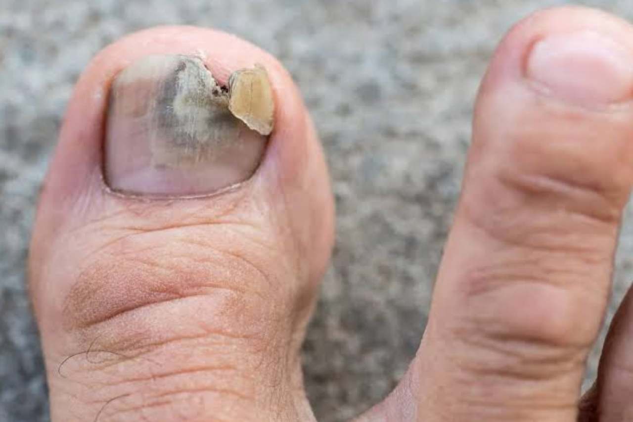 Nail and foot care