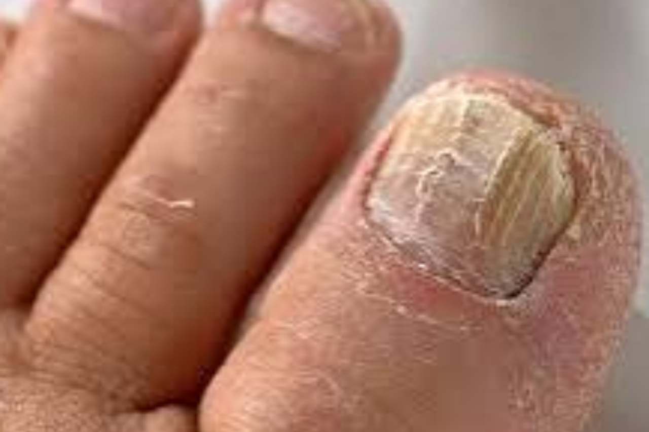 Nail and foot care