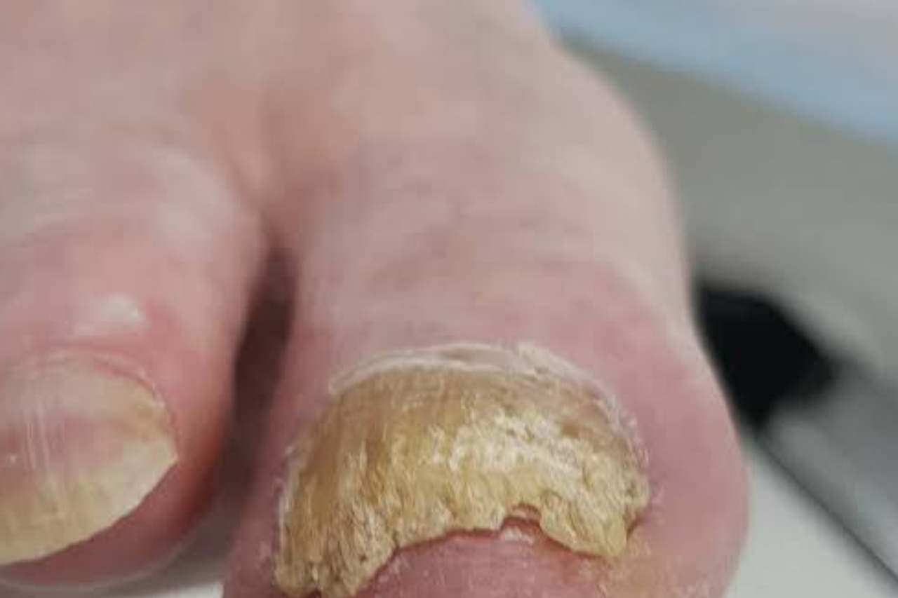 Nail and foot care