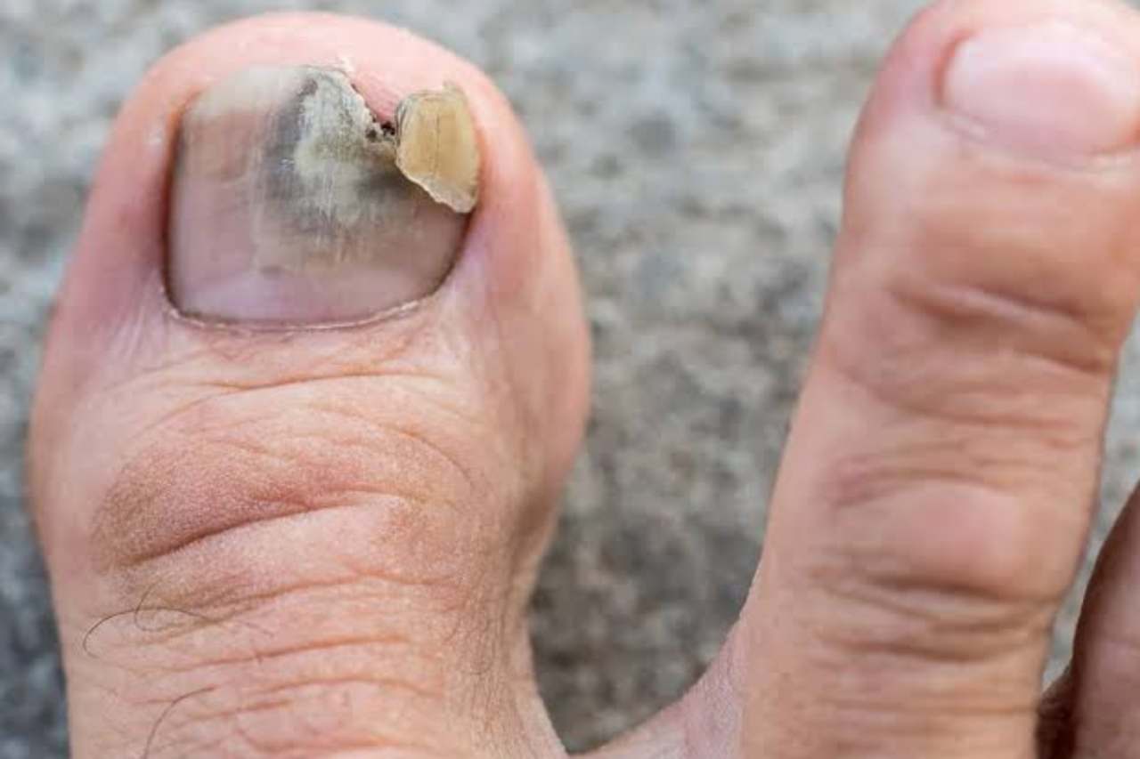 Nail and foot care