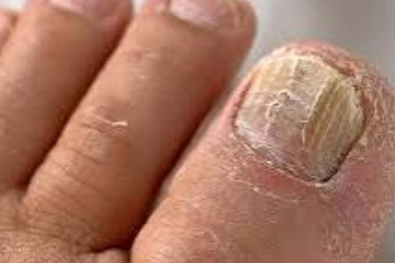 Nail and foot care