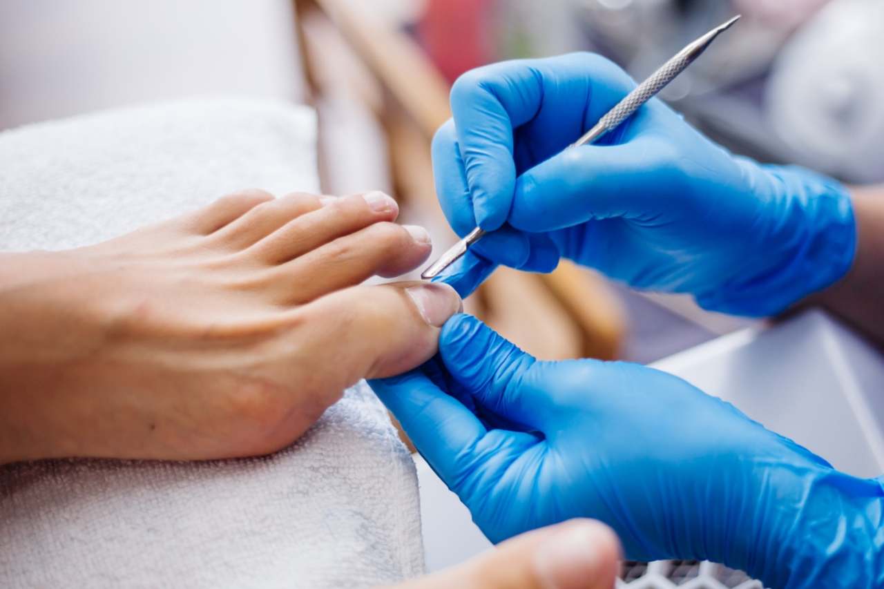 Nail and foot care