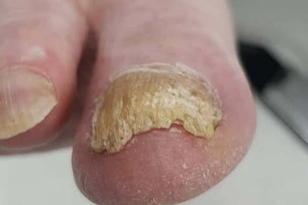Nail and foot care