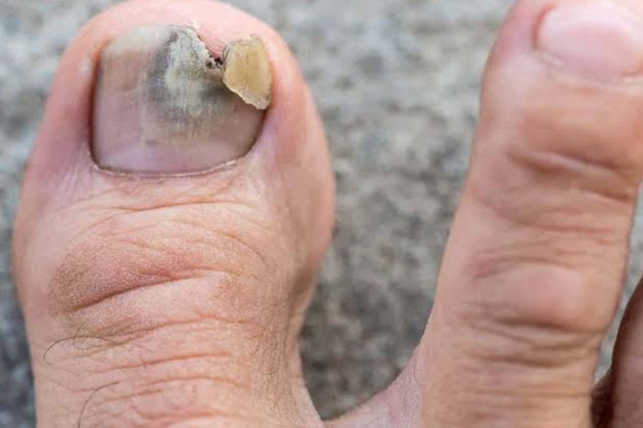 Nail and foot care