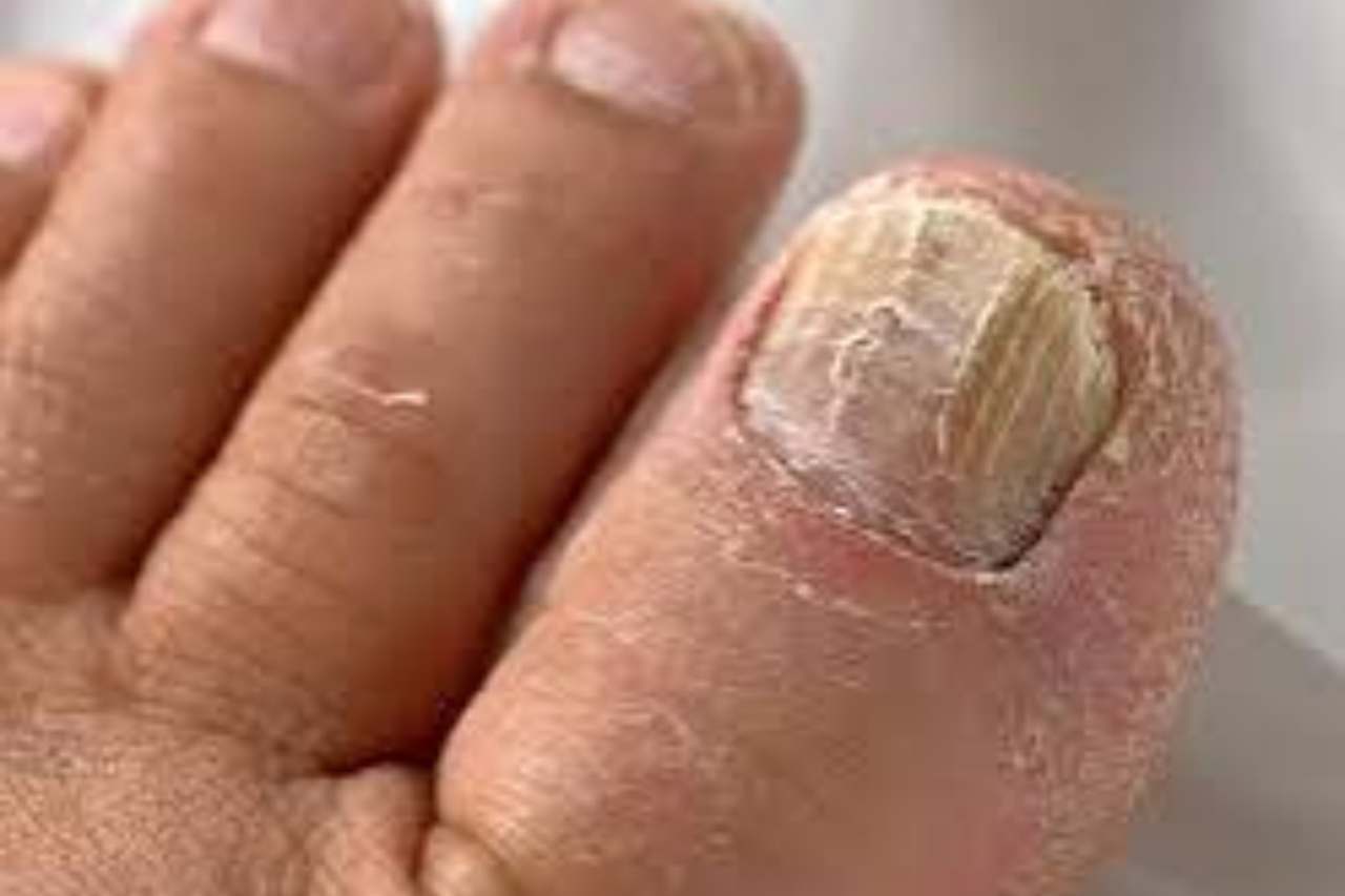 Nail and foot care