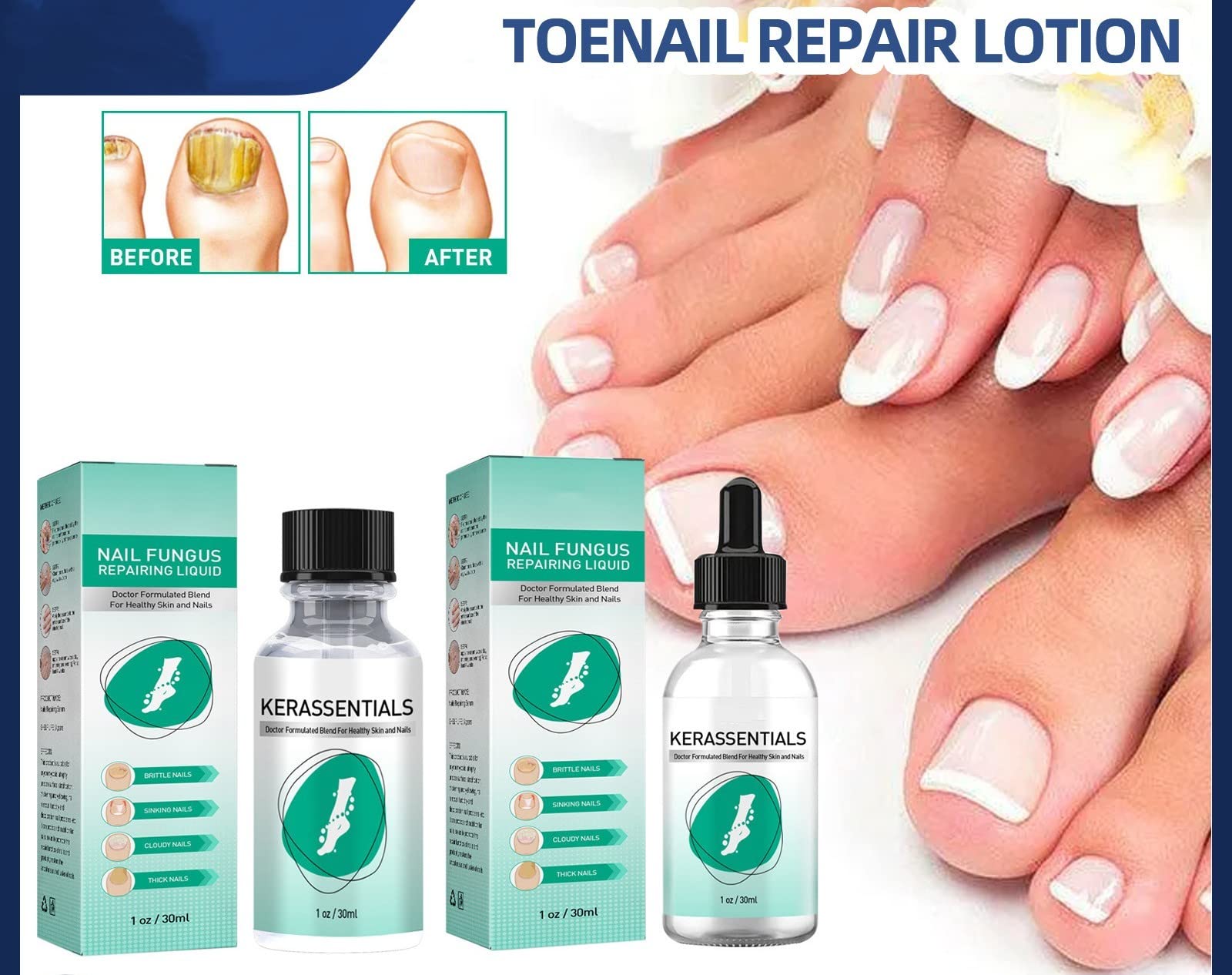 Toenail Fungus Signs: Everyday Checklist